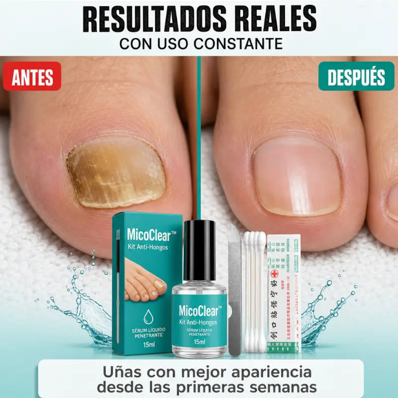MicoClear™: Kit Anti-Hongos