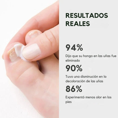 Podex™ – Uñas sanas y sin vergüenza en 21 días. PACK 2x1