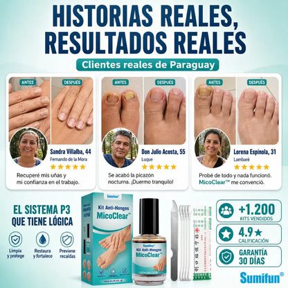 MicoClear™: Kit Anti-Hongos
